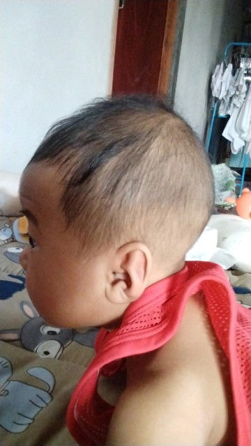 หัวแบนดูอย่างไงคะ