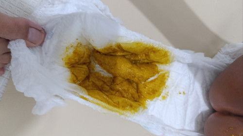 Bab cair bayi 8 bulan