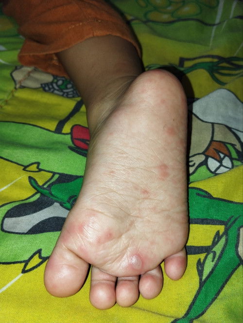 Mungkin disini ada yg sudah ngalamin baby nya seperti ini, solusinya dong bunda² , ini kenapa ya?