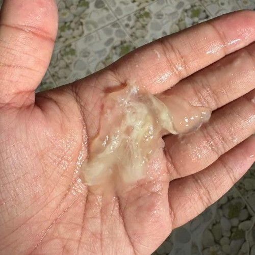 มูกใสออกมากี่วันคลอด