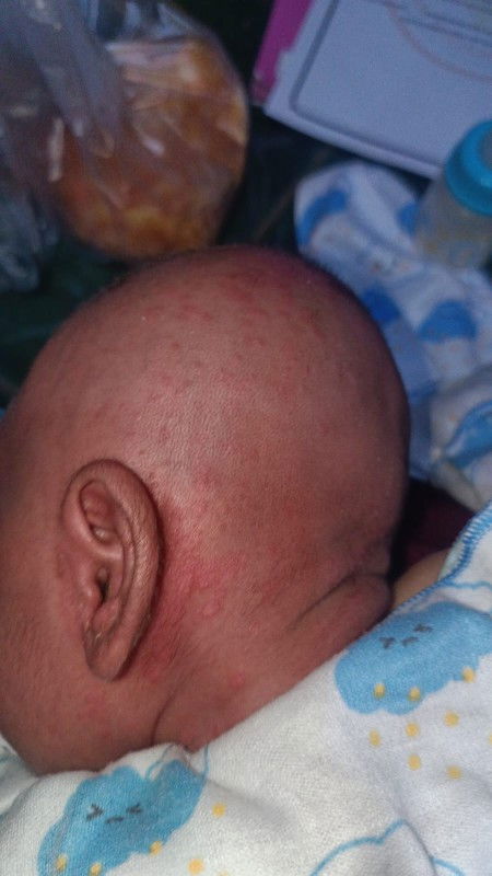 bunda" maaf mau tanya saya kan baru punya anak kalo kepala bayi kaya gini ilangnya pakai apa ya