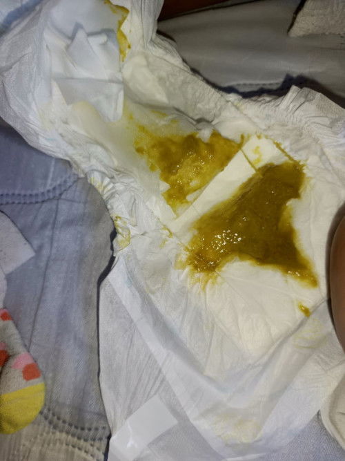 Sawan po ba ito? Normal po ba to?