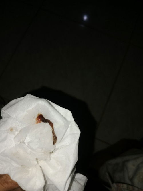 Assalamu'alaikum, usia hamil kedua 32week