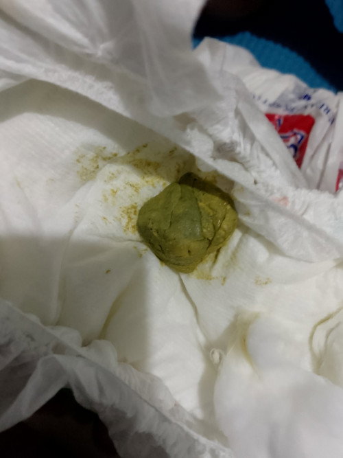 Hard poop ng 7 weeks baby