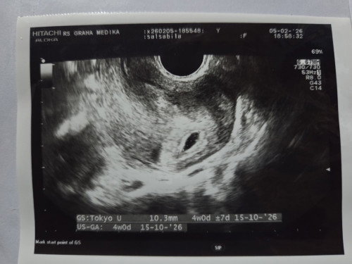 Ini hasil USG pertamaku week 4 ada yg bisa tolong jelasin? apa semuanya normal,dan letak baby nya