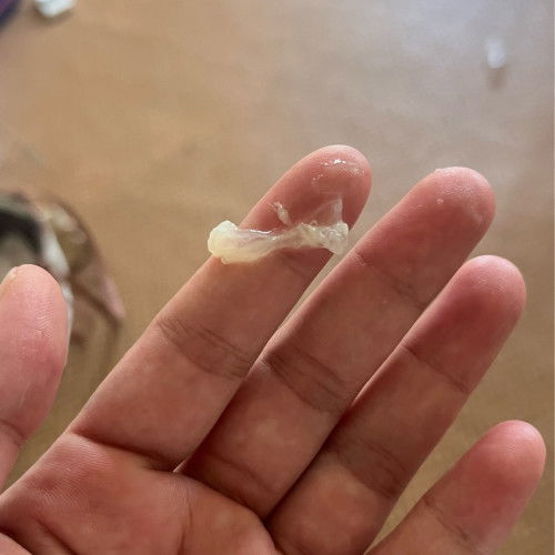 ท้อง39วีค 3วัน