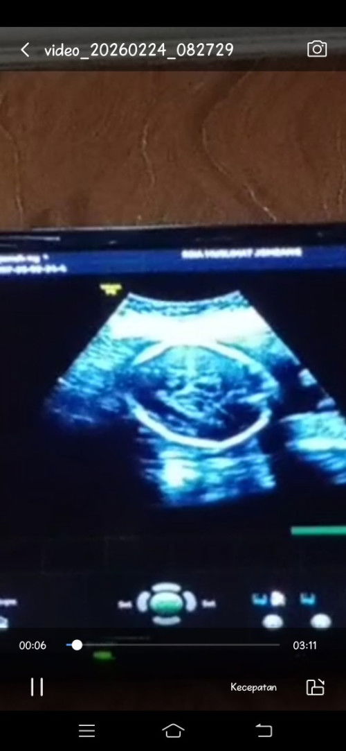 Bentuk usg kepala 25 mnggu