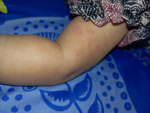 Tanya dong bunda hebat