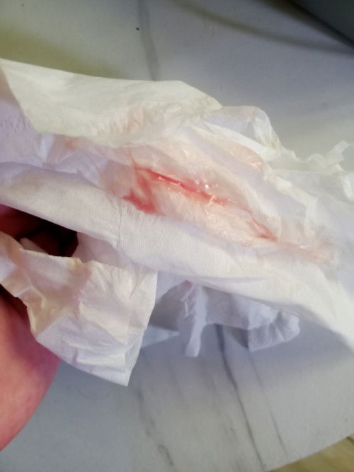 Bunda aku mau tanya ini flek tanda awal kehamilan bukan ya?