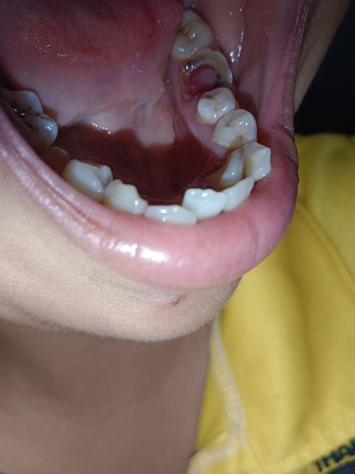 ขออนุญาตถาม