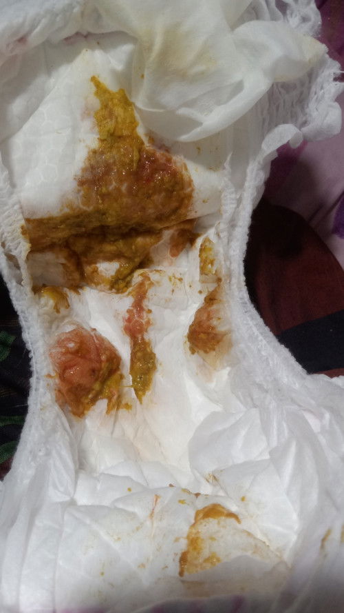 Bayi 7 bulan bab terus