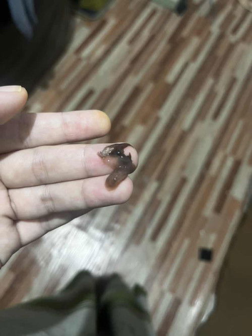 Ni tanda spotting / janin takjadi & gugur sendiri ye ?