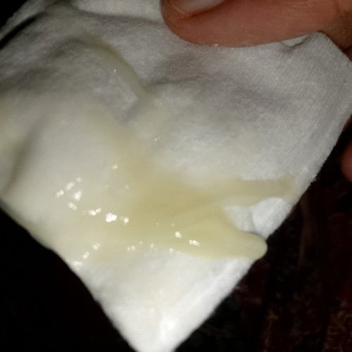 38วีค3วัน
ท้องเเข็ง