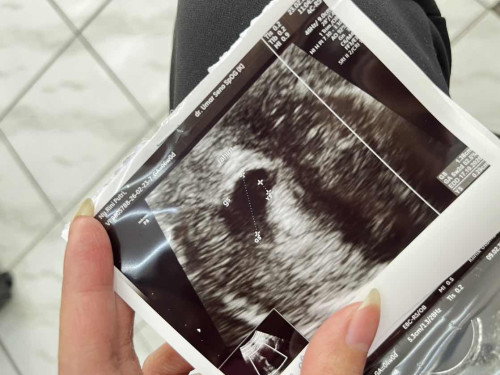 Hamil ke 2 anak pertama