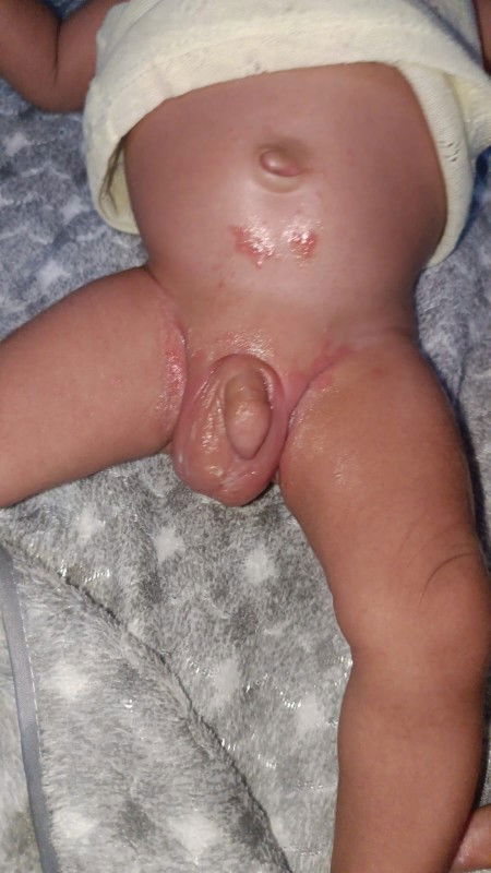 bun maaf mau tanya kira" salep apa ya yg cocok untuk iritasi kaya gini