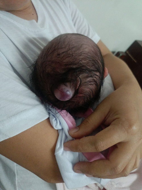 Super lambot na parang bukol