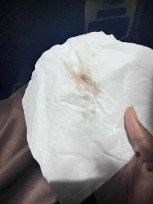 ท้อง 5 weeks