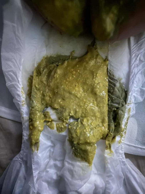 สีนี้ปกติมั้ยค่ะ
ฃ