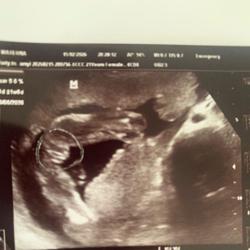 hasil usg kira kira ini udah fix cewe blm ya heheh