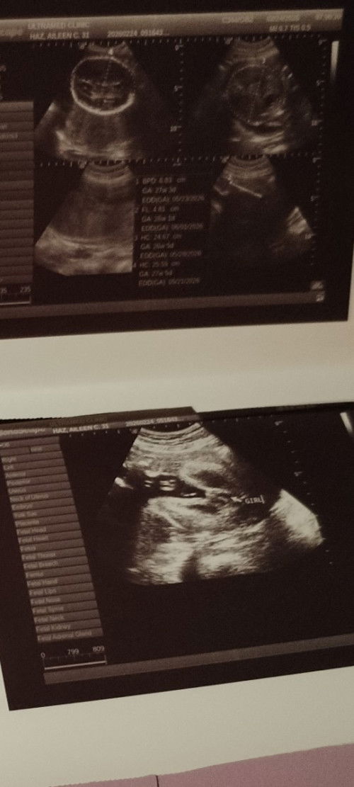 Hello 29 weeks and 2 days
It's a baby girl ♥️