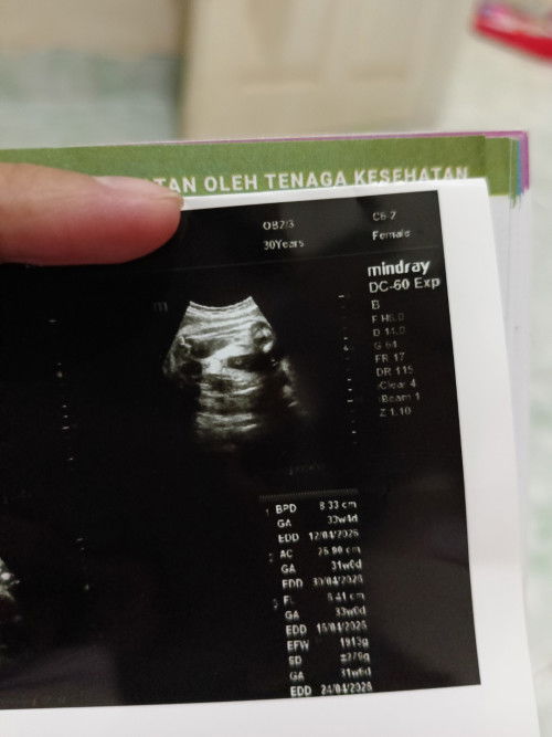 USG Berbeda Jenis Kelamin