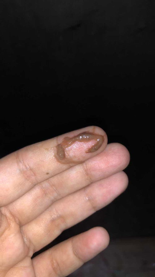 Apa ini tanda akan melahirkan?