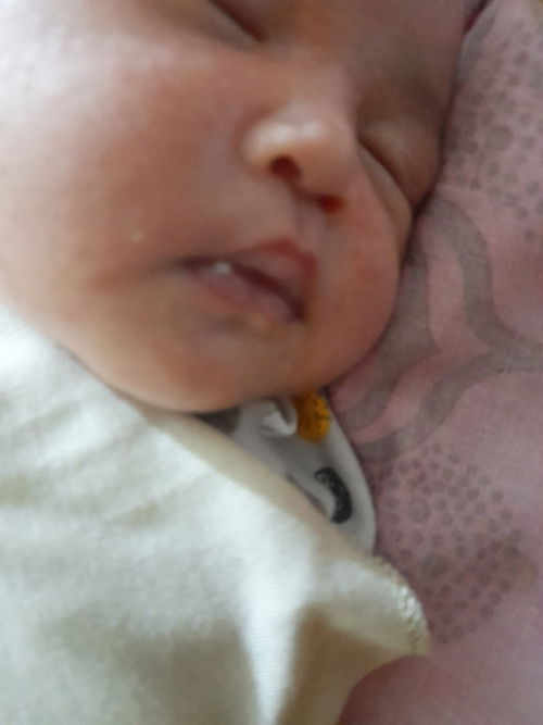 Putih putih di bibir