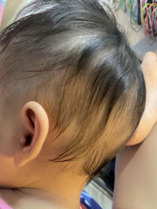 แบบนี้หัวแบนมั้ยคะ