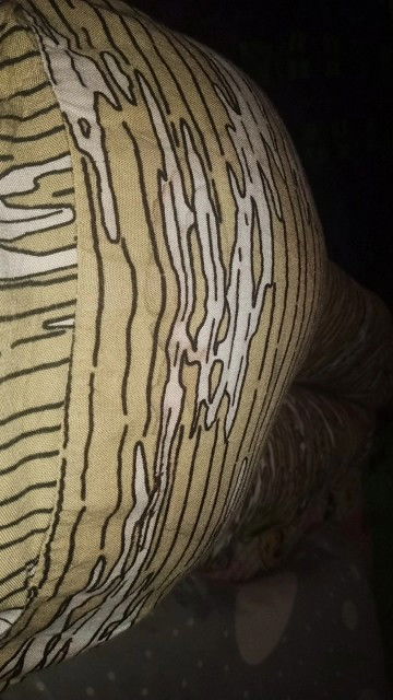 37week2day, disini ada gk yang hamil perut nya suka mencong" gni,, rasanya sakit bngtt kalo lagi gni