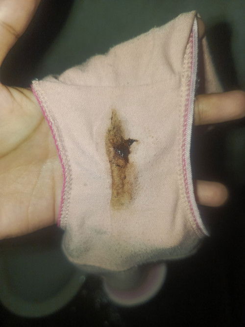 Galing po akong depo then hindi na po ako nag paturok di pa po ako nag mens ano po ibig sabihin nito