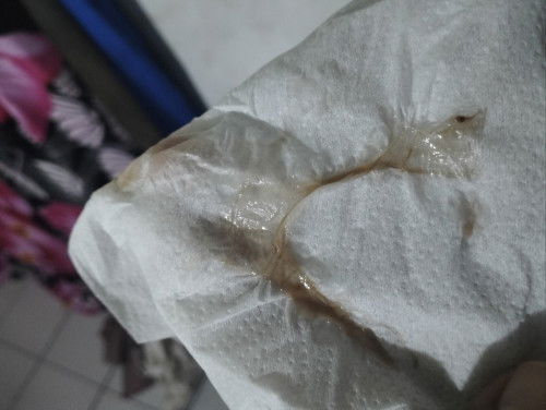 Apa saja tanda melahirkan dok?