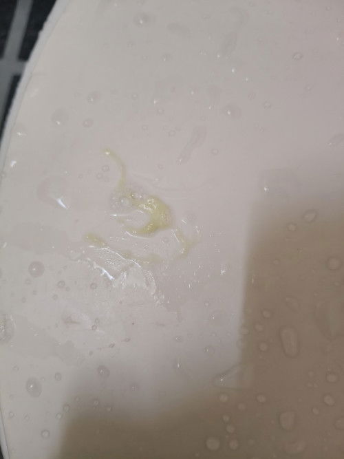 ตกขาว เป็นสีออกเหลืองๆๆ