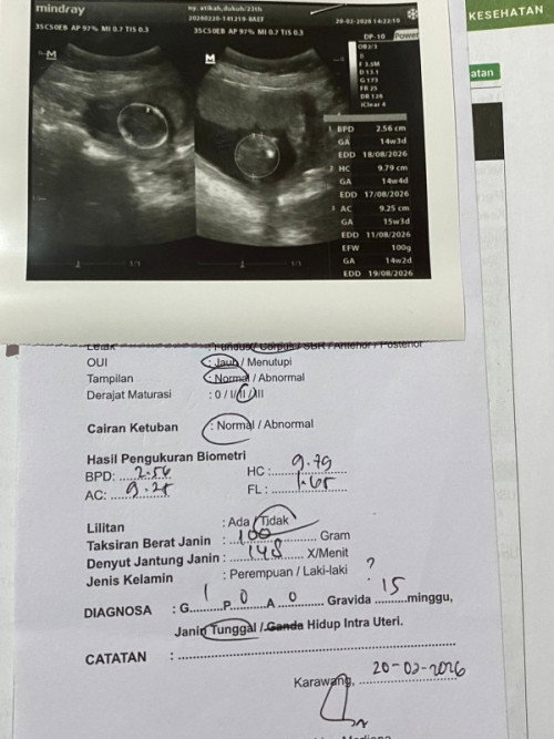 Izin bertanya bundaa