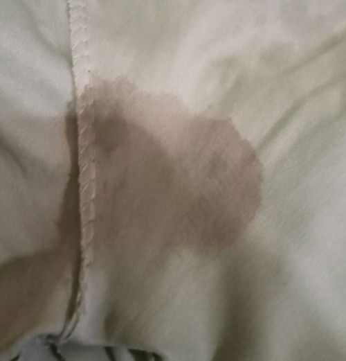 LG hamil 7 Minggu barusan keluar darah apakah berbahaya