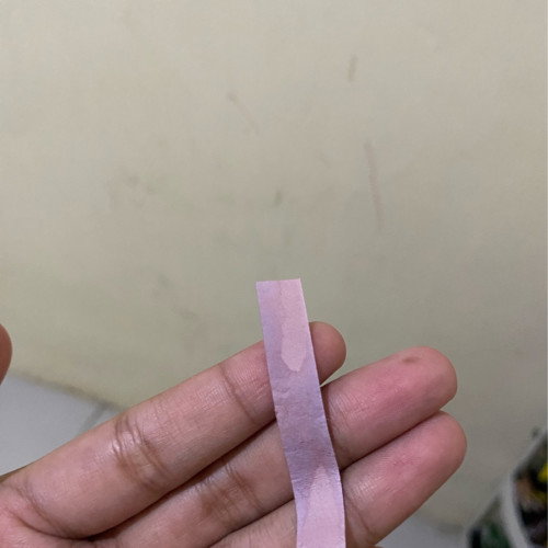 20 weeks air ketuban rembes