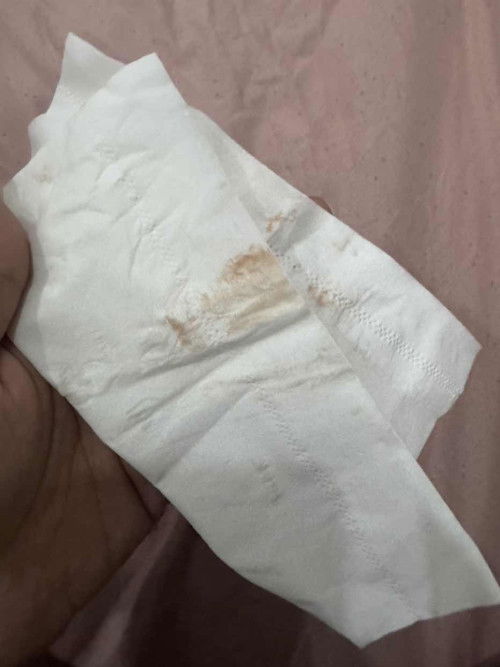 8Weekมีเลือดออกนิดๆแต่ไม่ปวดท้อง