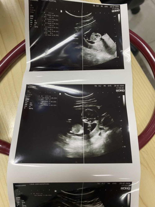 สอบถามแม่ๆหน่อยค่ะ