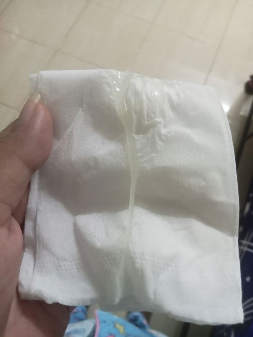 มีมูกใสๆออกมาเยอะมากกก