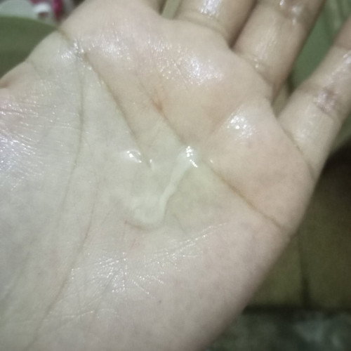 Usia kehamilan 33 week tengah bulan keluar lendir anak ke 2 normal ga bun? 🥺🙏🏻