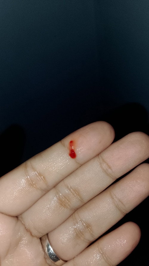 Keluar keputihan coklat samar dan darah