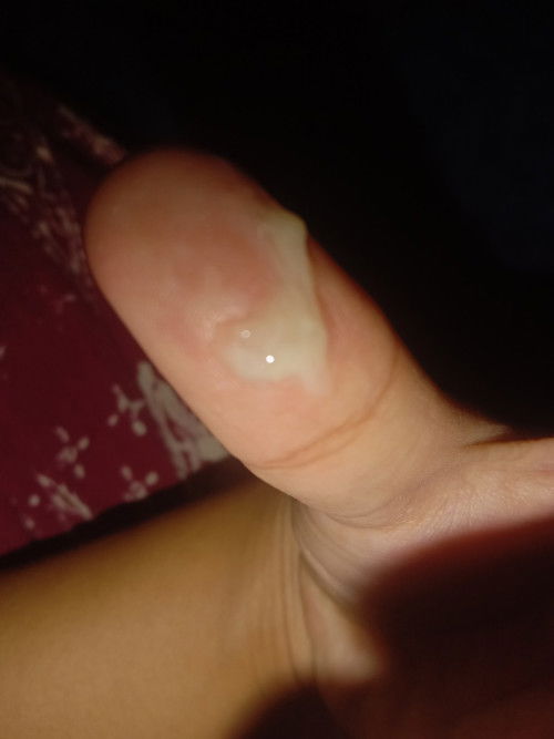 normal gak bun keputihan terus menerus saat hamil 34 minggu?