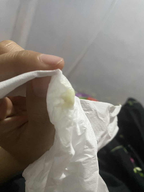 Keputihan hamil