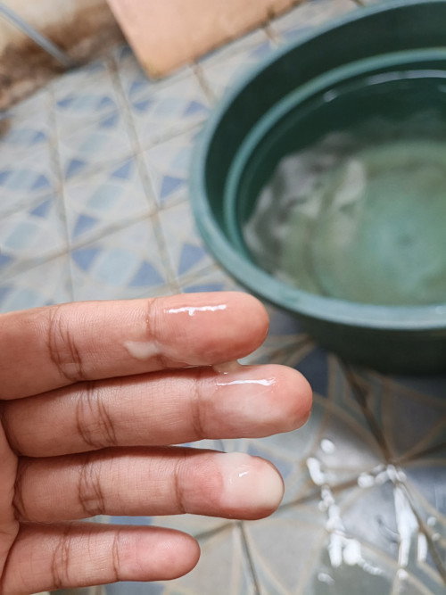 Bun mau tanya ini keputihan apa ketuban rembes yaa tekstur nya encer usia kehamilannya skrg 36week