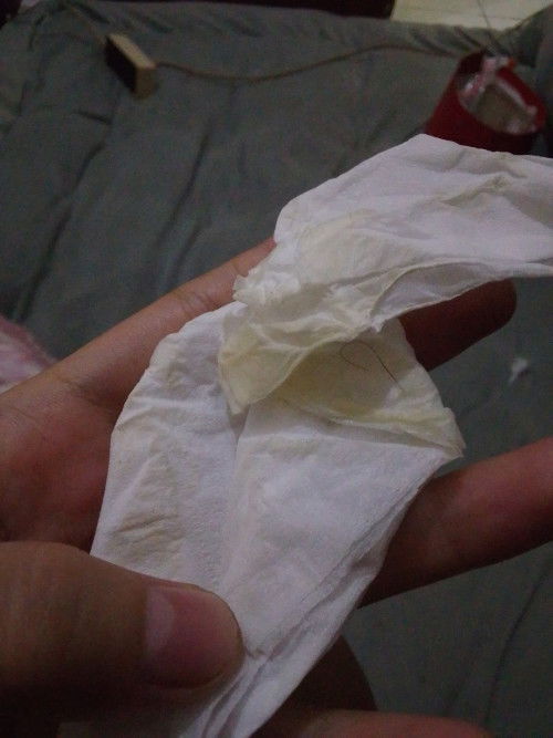 Keluar lendir kaya gini, tanpa flek usia 37week 3day, aman ga ya bun?knp ya hu anak pertama soalnya