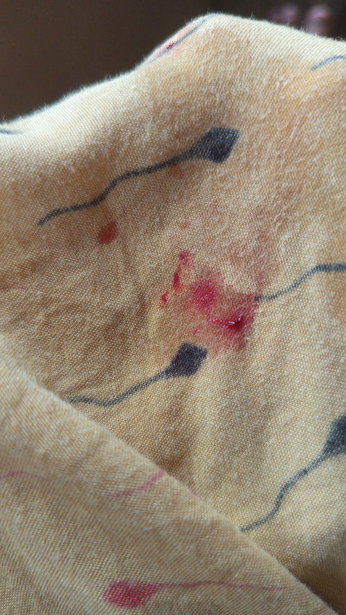 Keluar darah pas usia kandungan 12minggu