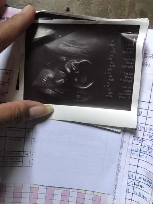 20+5วีค น้ำหนักลูกตกเกณฑ์276g