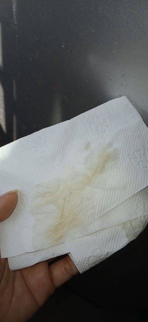 38+4 ปกติตกขาวสีใสตลอดรึไม่ก็ขาวๆแบบแป้งเปียก แต่วันนี้สีแบบนี้ ซับติดทิชชู่3-4แผ่น ออกแค่นี้แล้วหาย