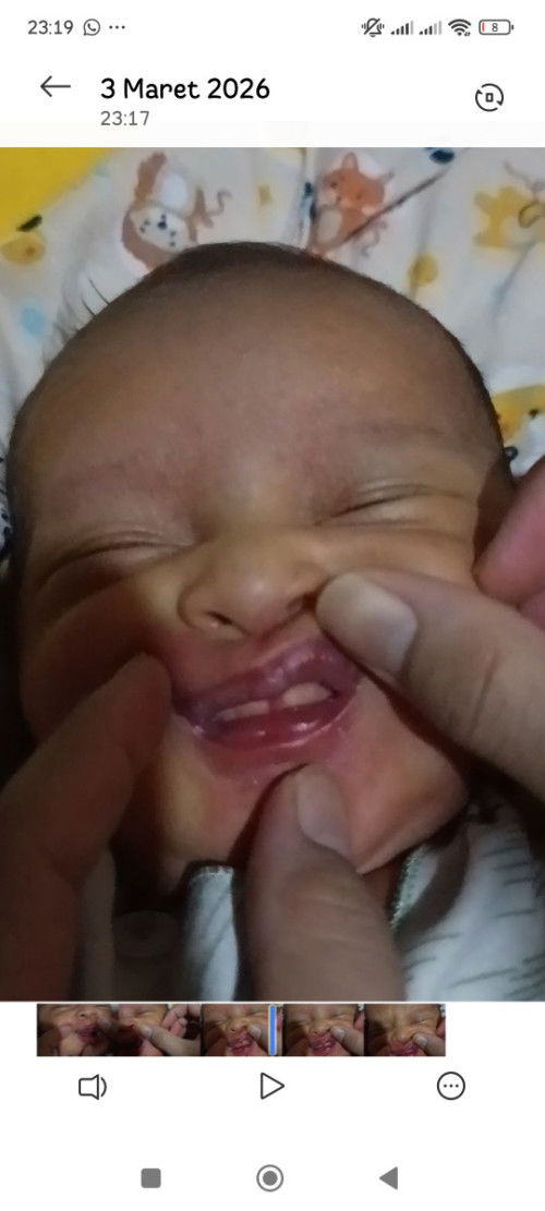 Gigi tumbuh usia bayi 22 hari