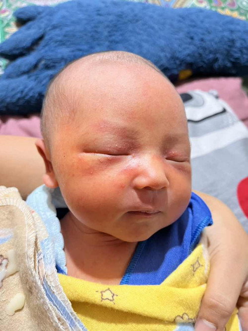 Mau tanya bun ini bayi aku usia 4hari kenapa muncul bintik2 gtu yaa?🥹