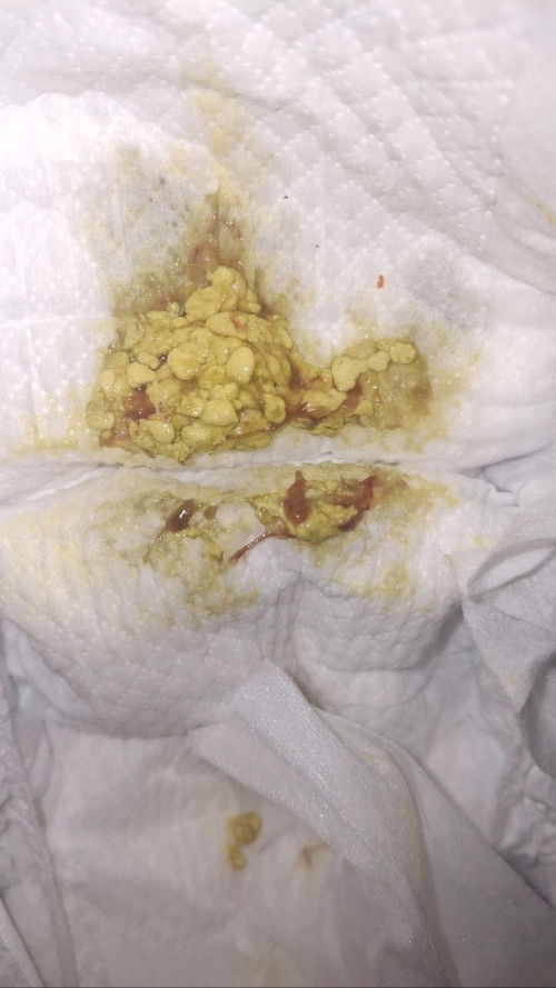 Pup bayi 1 bulan sufor